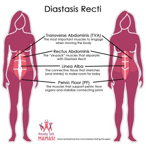 Pregnancy Pilates Diastasis Recti Diagram